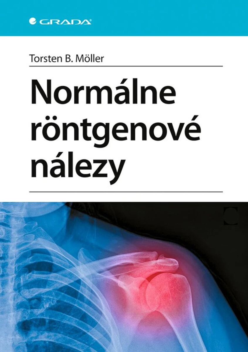 Kniha Normálne röntgenové nálezy