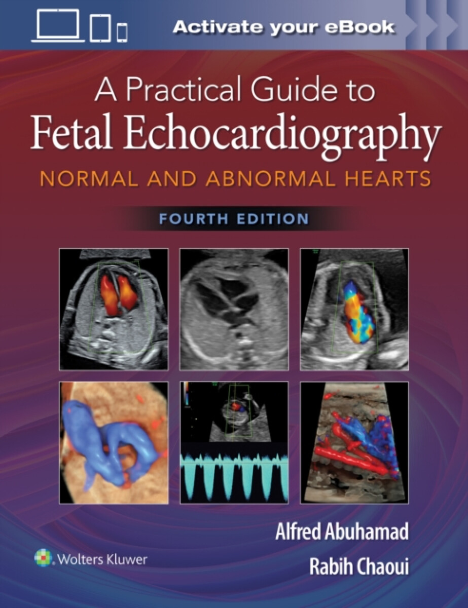 Kniha Practical Guide to Fetal Echocardiography