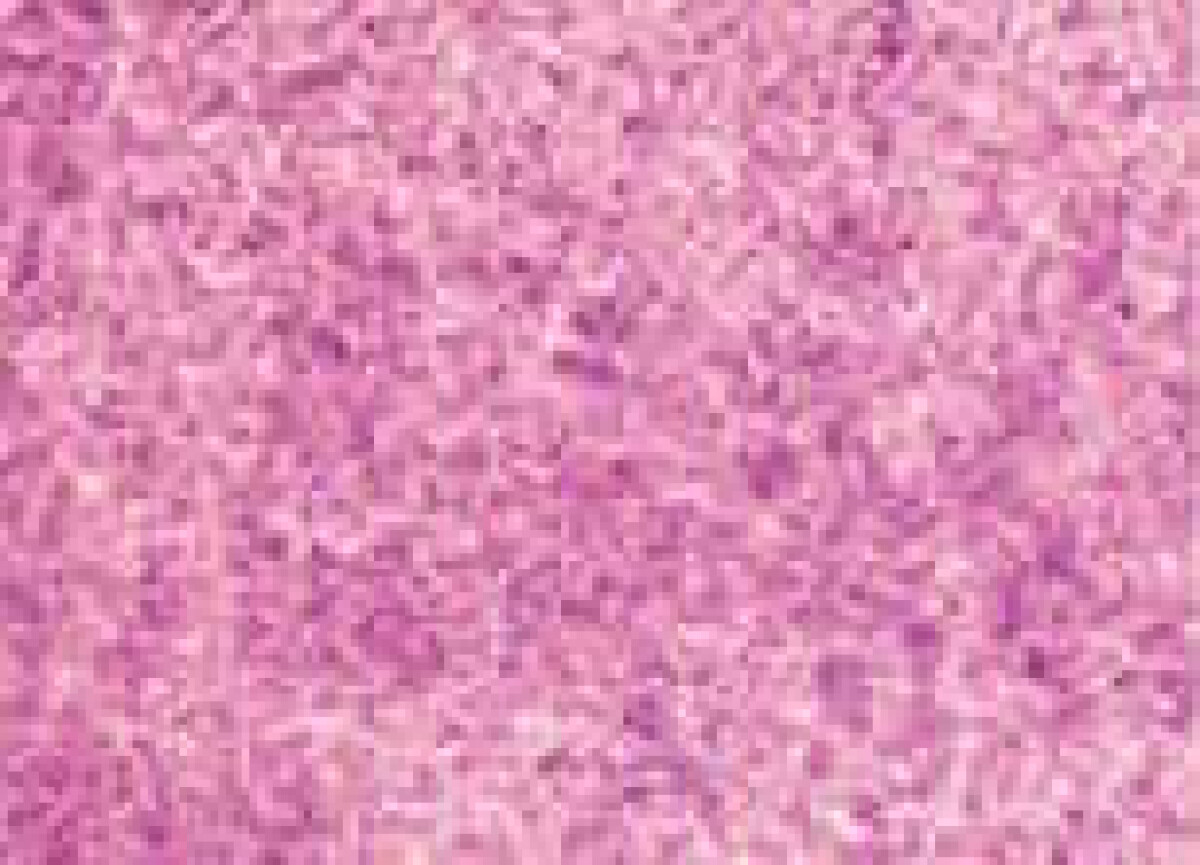 Akvarelová barva DS 15ml – 4050 Iridescent Vibrant Raspberry