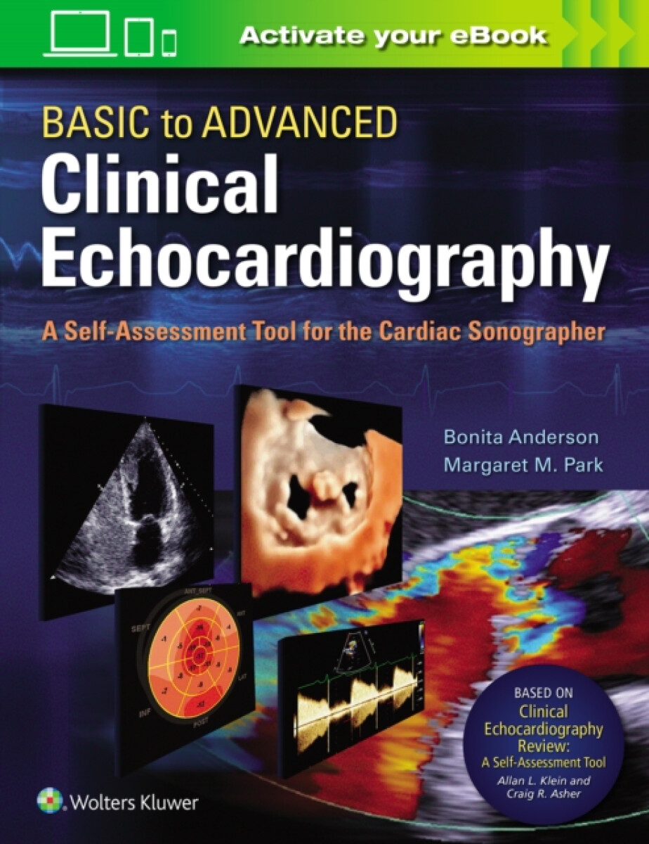 Kniha Basic to Advanced Clinical Echocardiography