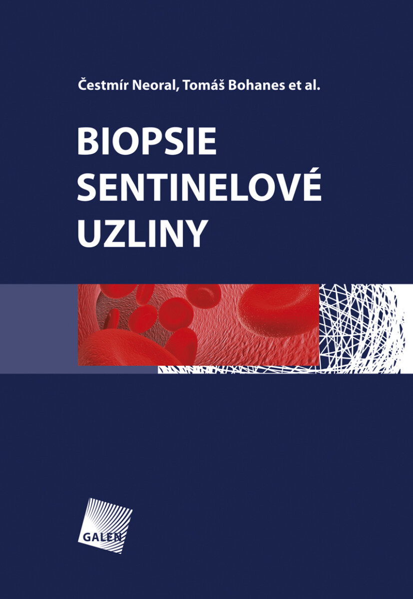 Biopsie sentinelové uzliny - Čestmír Neoral, Tomáš Bohanes