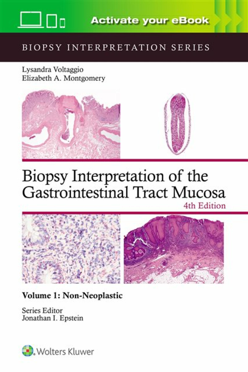 Kniha Biopsy Interpretation of the Gastrointestinal Tract Mucosa Volume 1