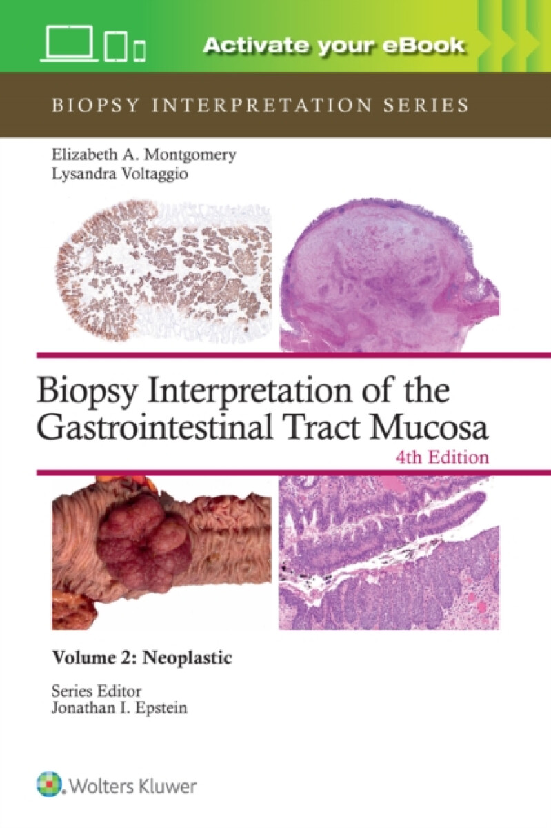 Kniha Biopsy Interpretation of the Gastrointestinal Tract Mucosa Volume 2