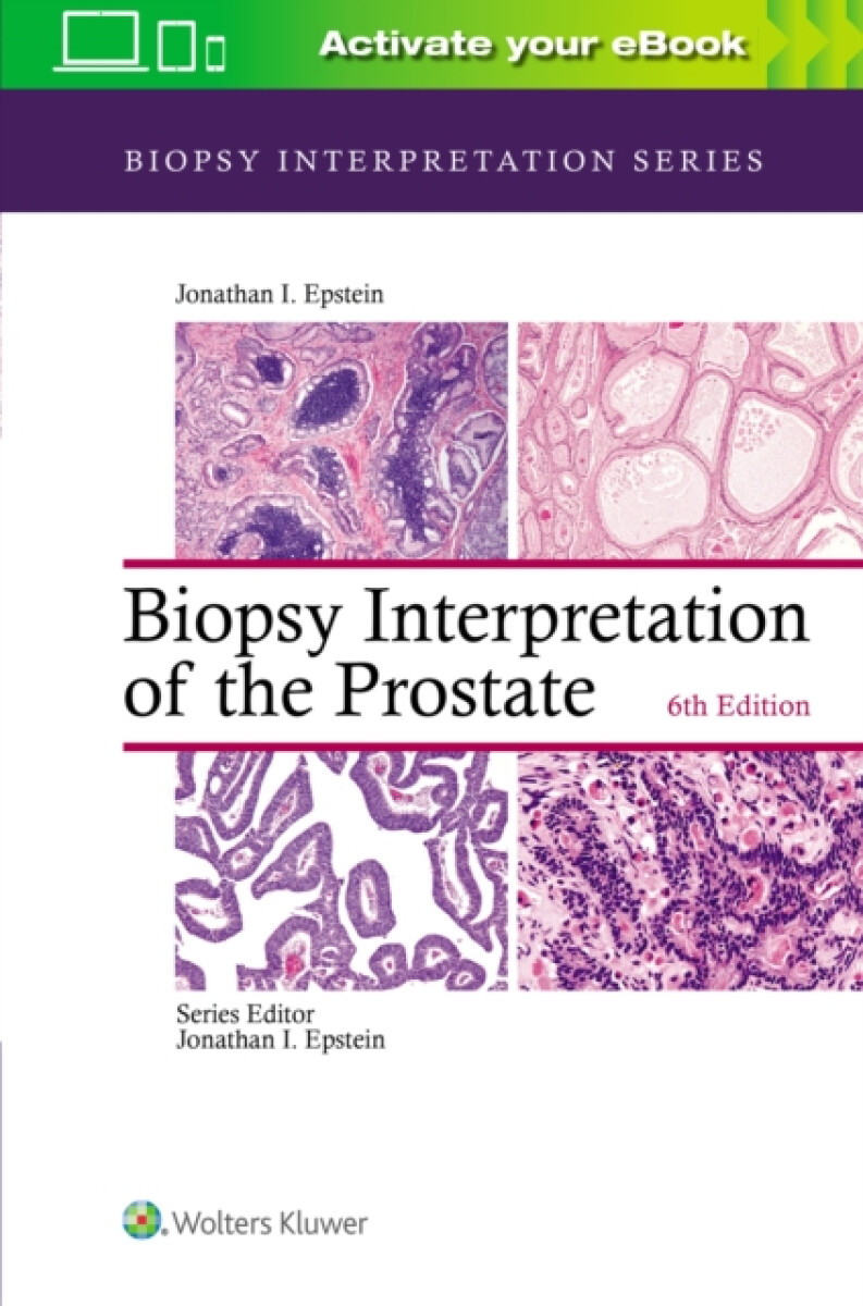 Kniha Biopsy Interpretation of the Prostate