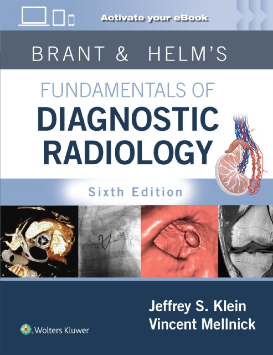Kniha Brant a Helm's Fundamentals of Diagnostic Radiology: Print + eBook with Multimedia