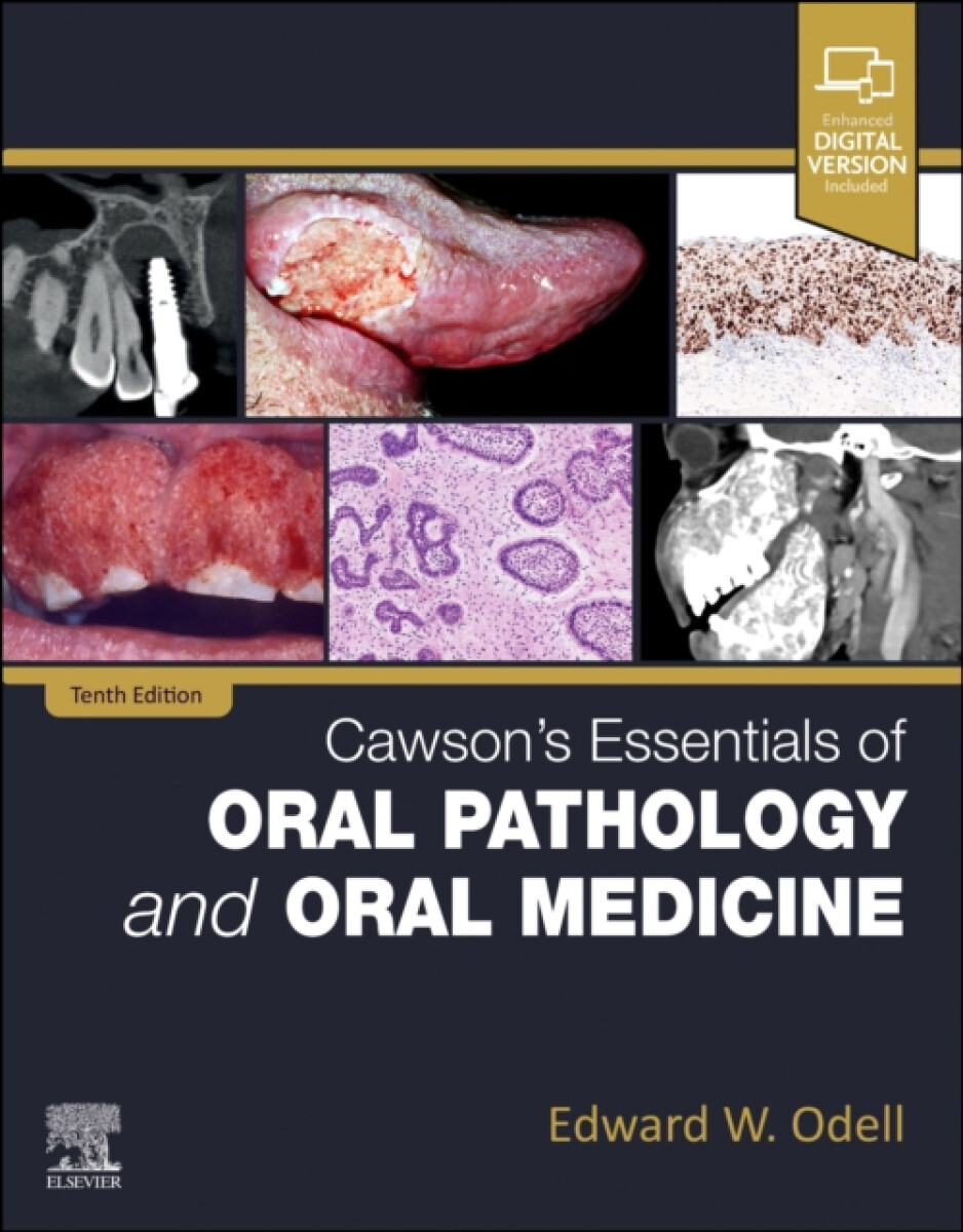 Kniha Cawson's Essentials of Oral Pathology and Oral Medicine