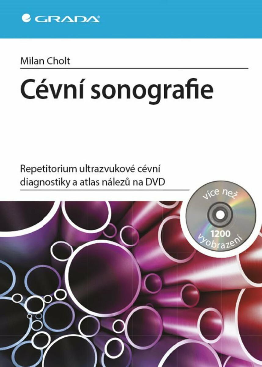 Kniha Cévní sonografie. repetitorium ultrazvukové cévní diagnostiky a atlas nálezů na DVD