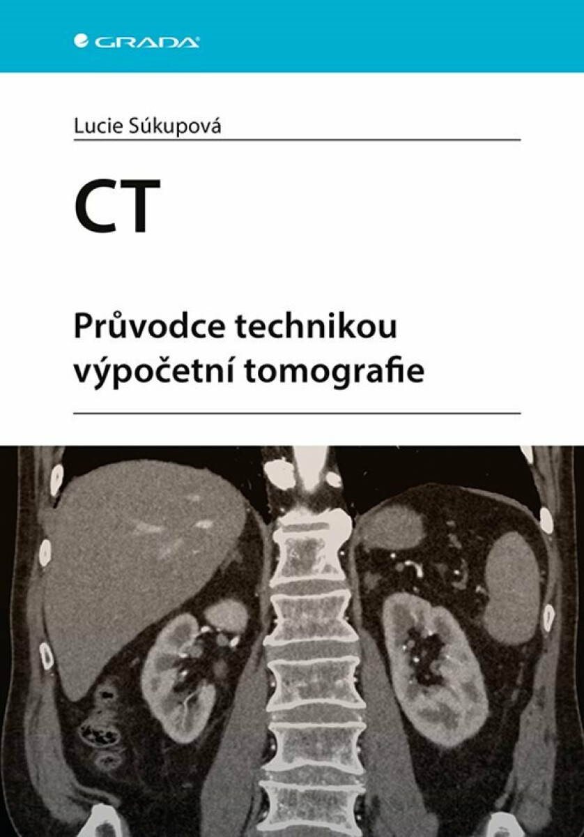 CT - Průvodce technikou výpočetní tomografie koupíte na Knihydobrovsky.cz