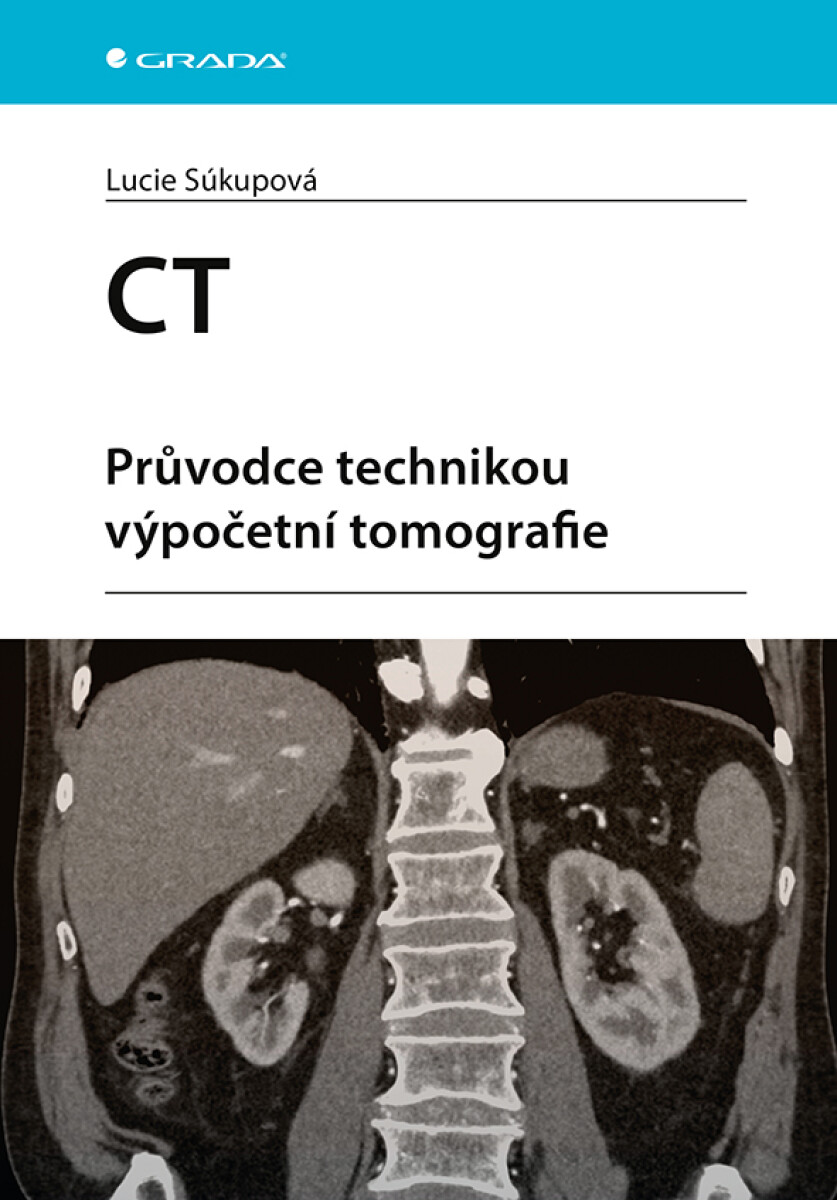 CT - Průvodce technikou výpočetní tomografie - Lucie Súkupová