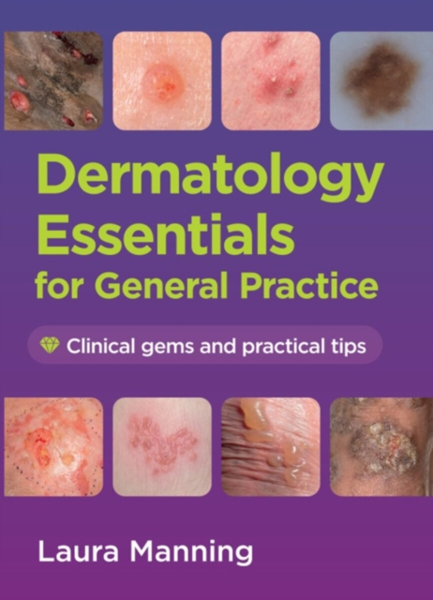 Kniha Dermatology Essentials for General Practice