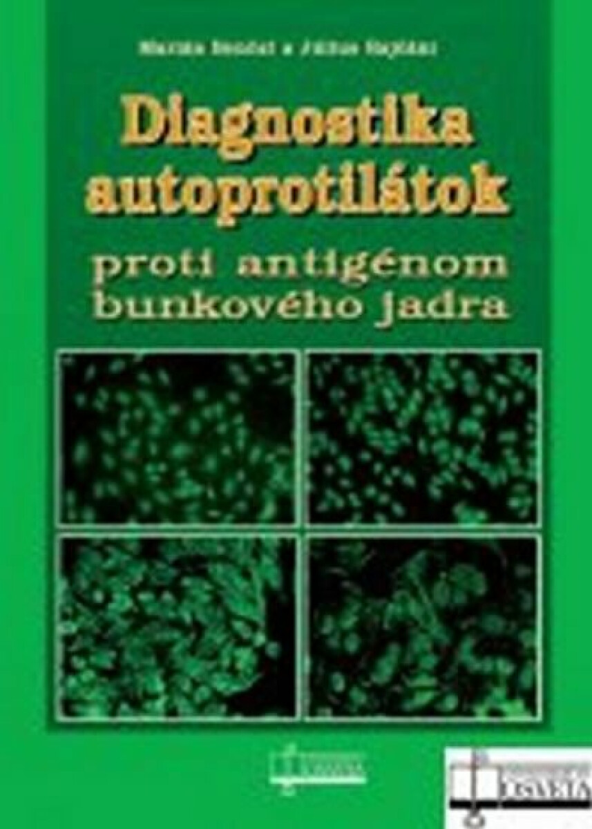 Kniha Diagnostika autoprotilátok