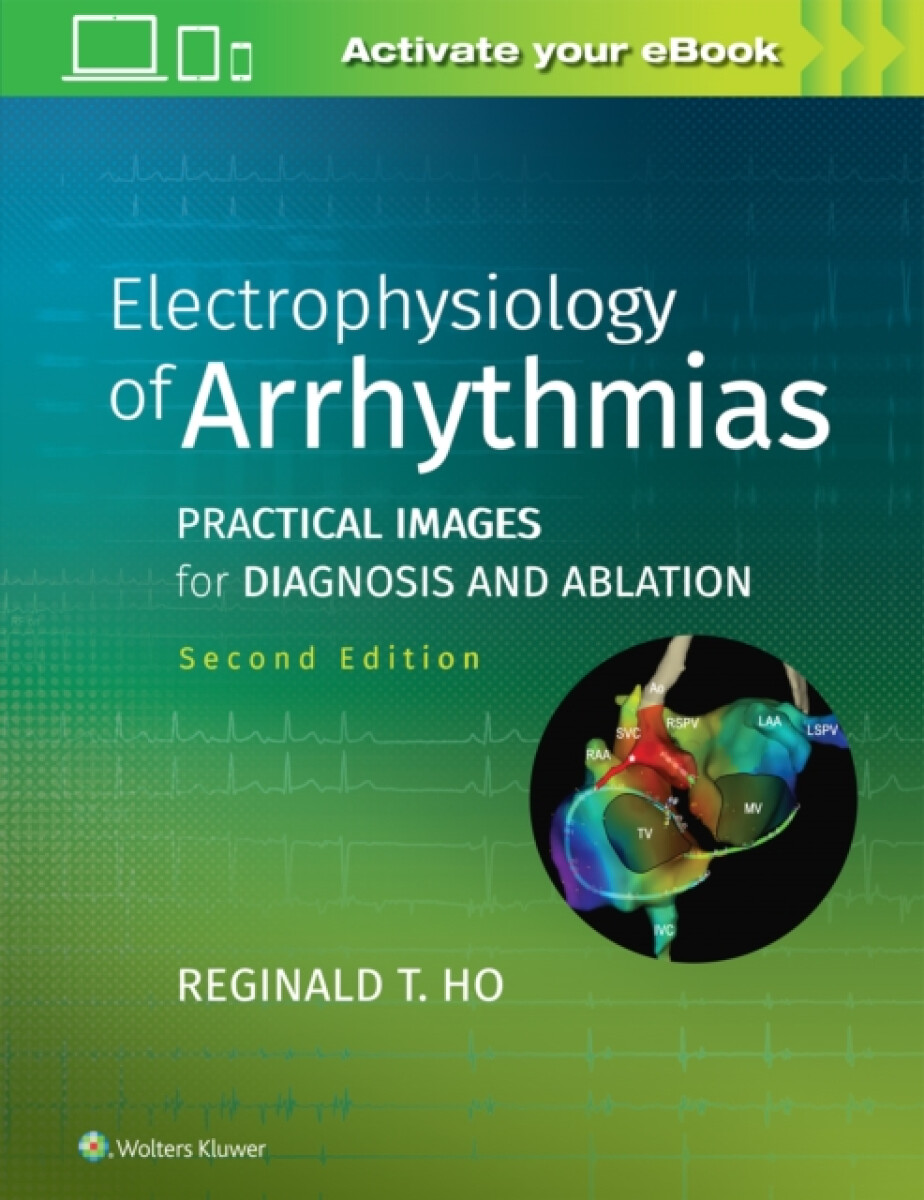 Kniha Electrophysiology of Arrhythmias