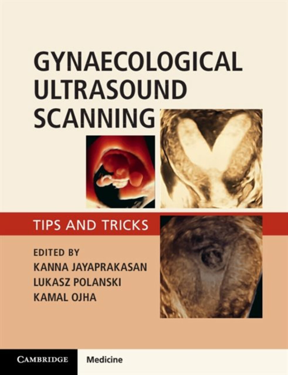Kniha Gynaecological Ultrasound Scanning