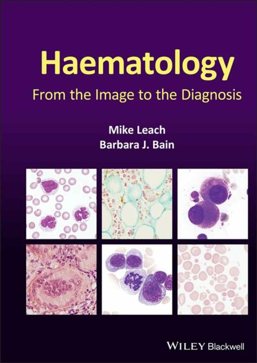 Kniha Haematology
