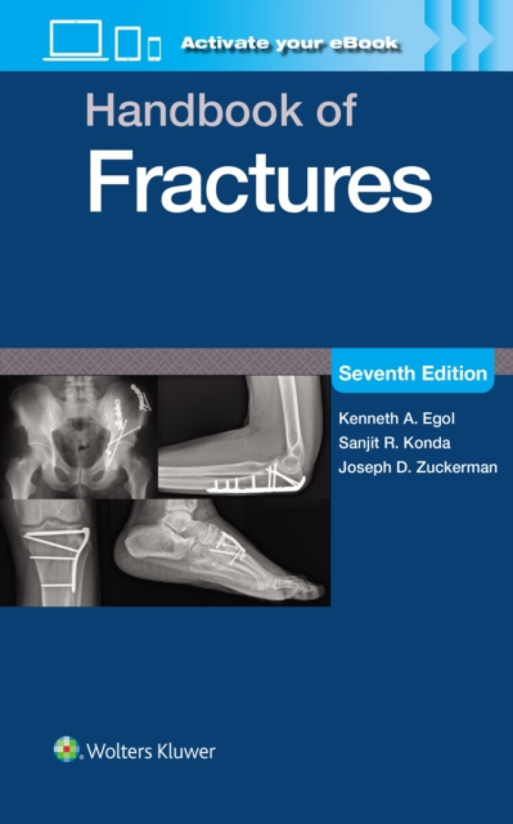 Kniha Handbook of Fractures: Print + eBook with Multimedia
