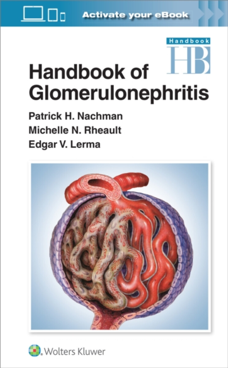 Kniha Handbook of Glomerulonephritis