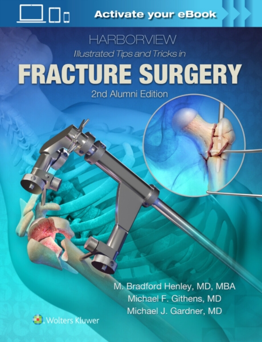 Kniha Harborview Illustrated Tips and Tricks in Fracture Surgery