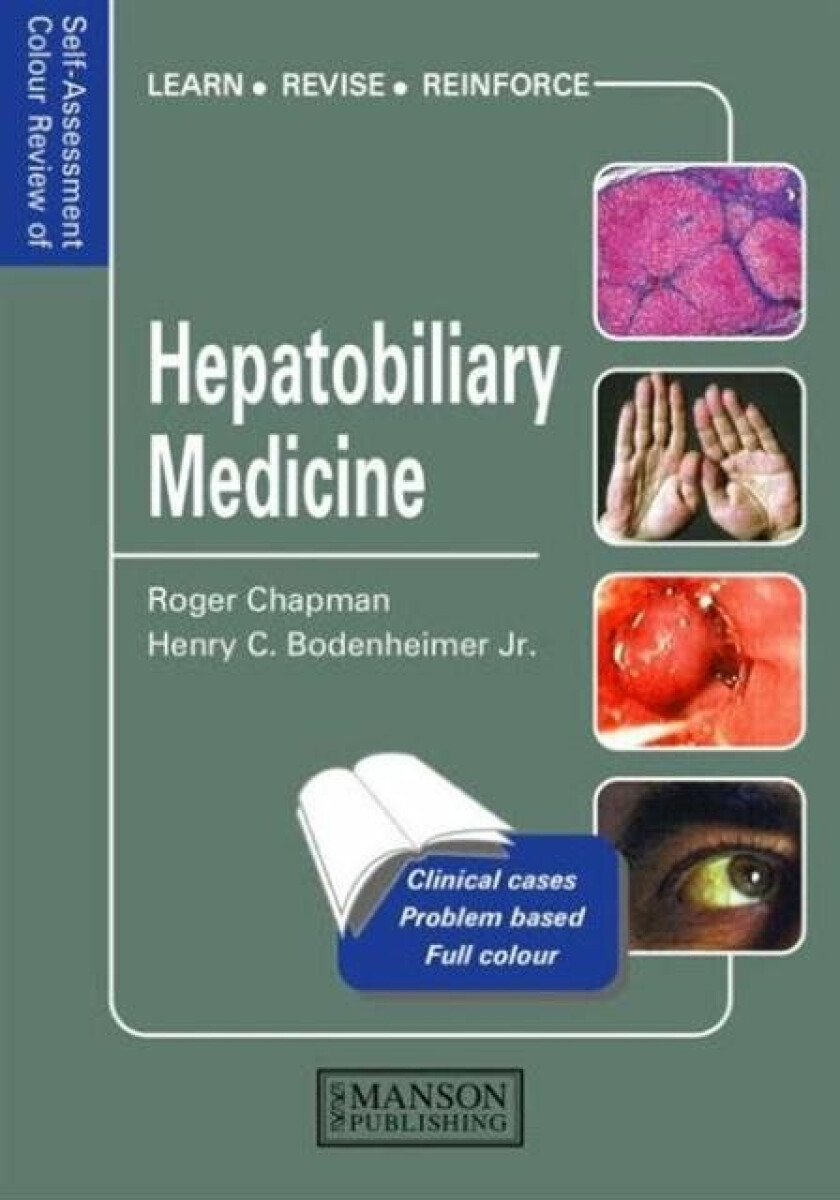 Kniha Hepatobiliary Medicine