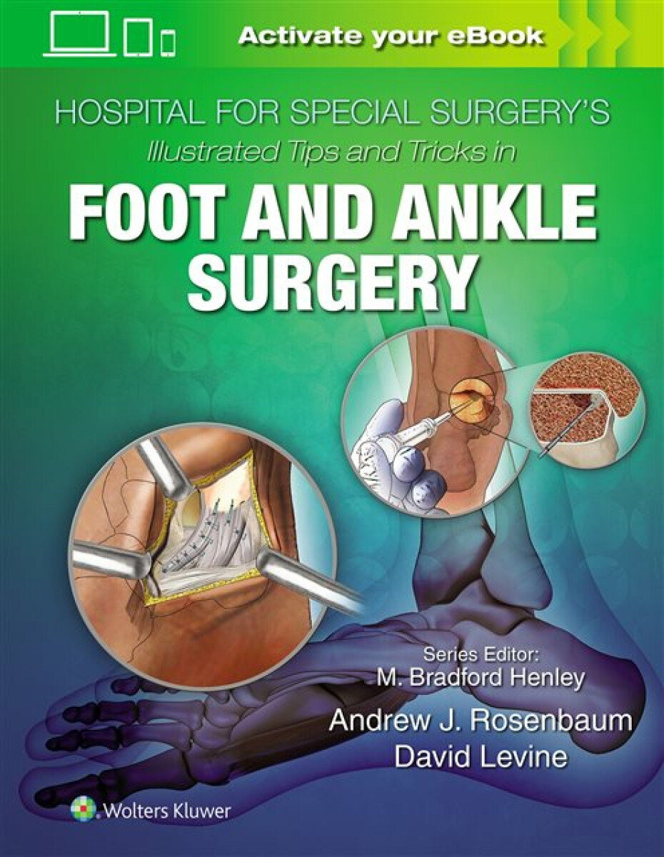 Kniha Hospital for Special Surgery's Illustrated Tips and Tricks in Foot and Ankle Surgery