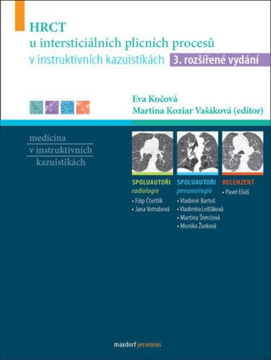 Kniha HRCT u intersticiálních plicních procesů v instruktivních kazuistikách, 3. vydání