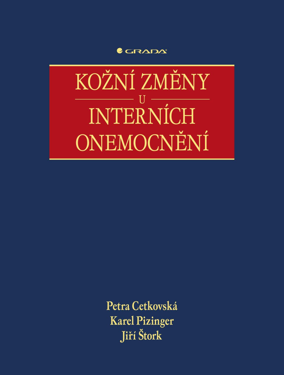 Kožní změny u interních onemocnění - Petra Cetkovská, Karel Pizinger, Jiří Štork