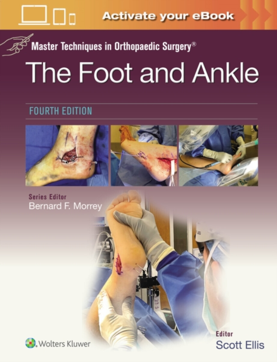 Kniha Master Techniques in Orthopaedic Surgery: The Foot and Ankle: Print + eBook with Multimedia