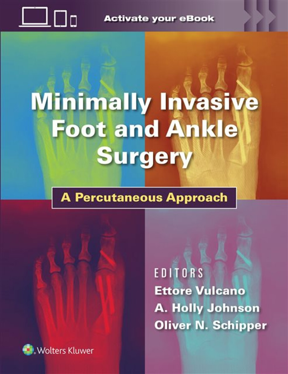Kniha Minimally Invasive Foot and Ankle Surgery