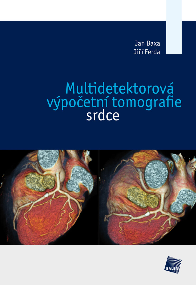 Multidetektorová výpočetní tomografie srdce - Jiří Ferda, Jan Baxa