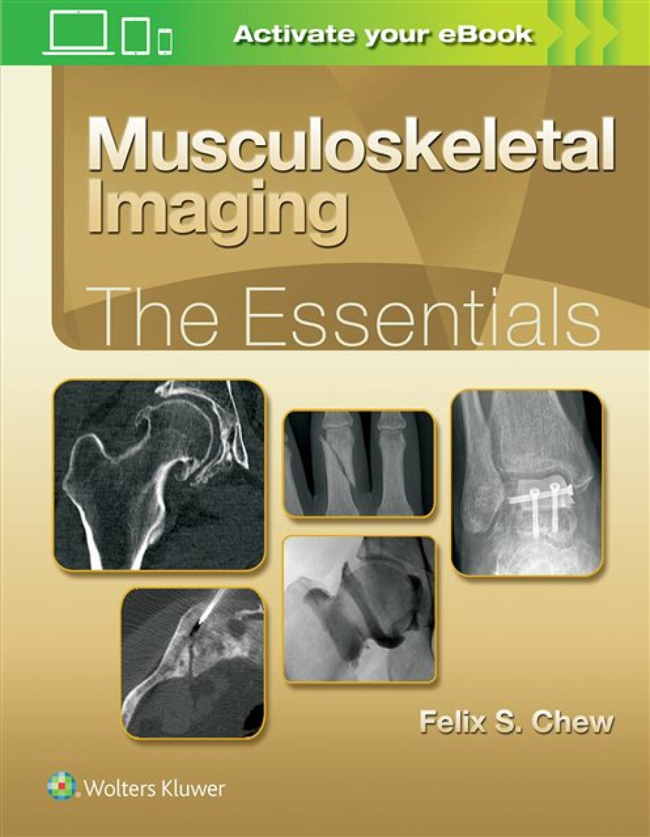 Kniha Musculoskeletal Imaging: The Essentials