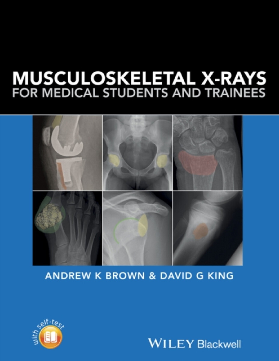 Kniha Musculoskeletal X-Rays for Medical Students and Trainees