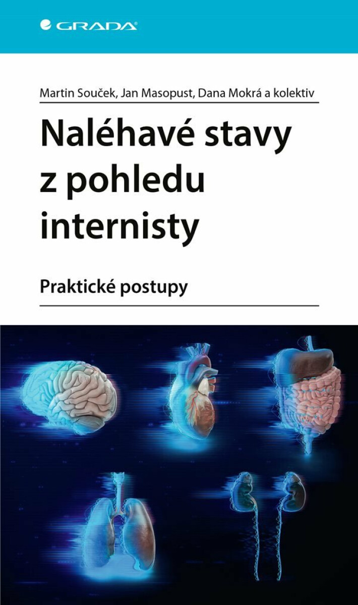 Kniha Naléhavé stavy z pohledu internisty - praktické postupy