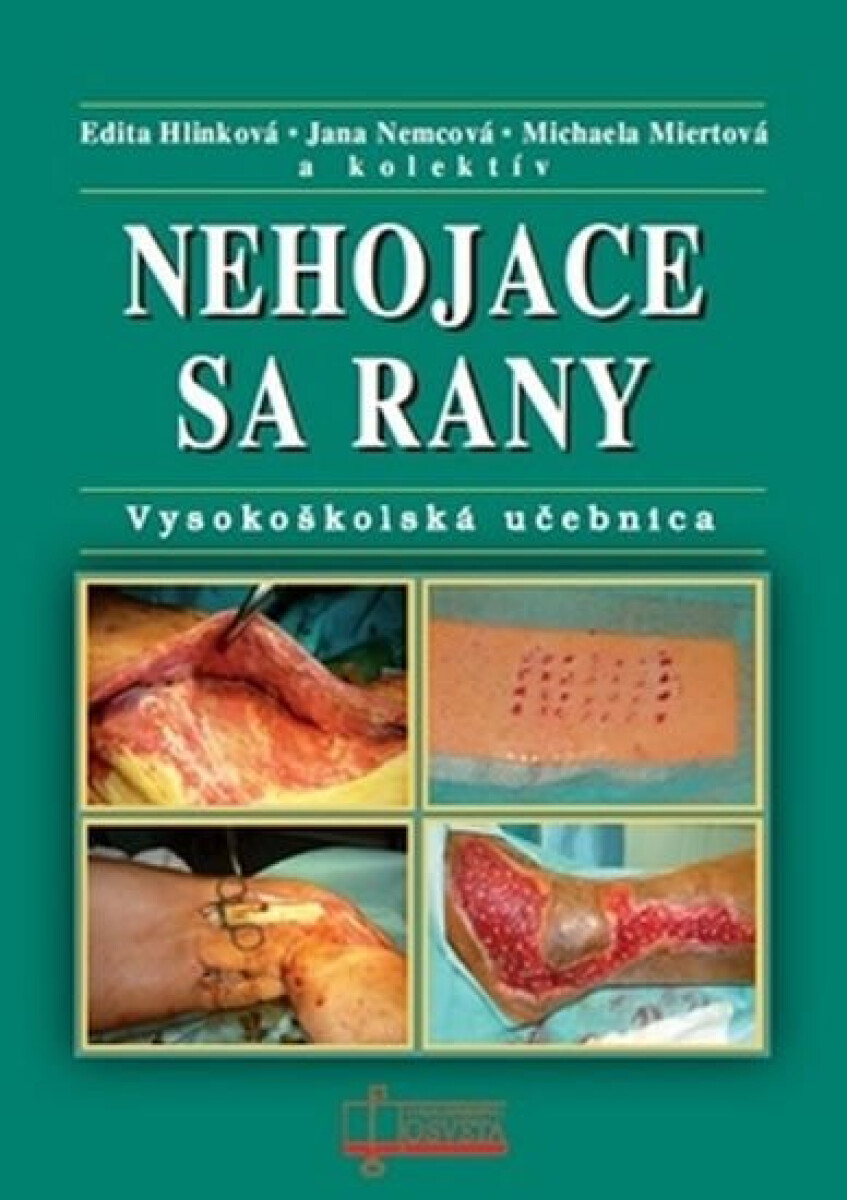 Kniha Nehojace se rany