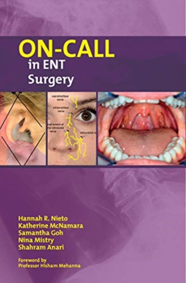 Kniha On-Call in ENT Surgery