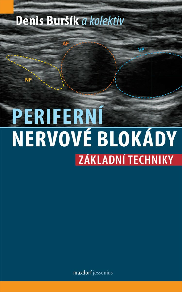 Kniha Periferní nervové blokády - Základní techniky
