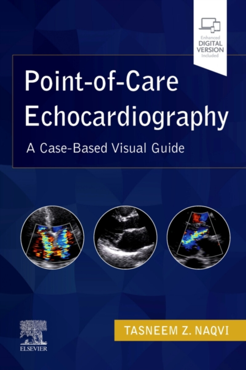 Kniha Point-of-Care Echocardiography