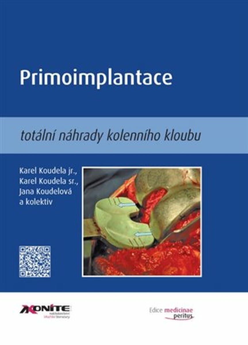 Kniha Primoimplantace totální náhrady kolenního kloubu