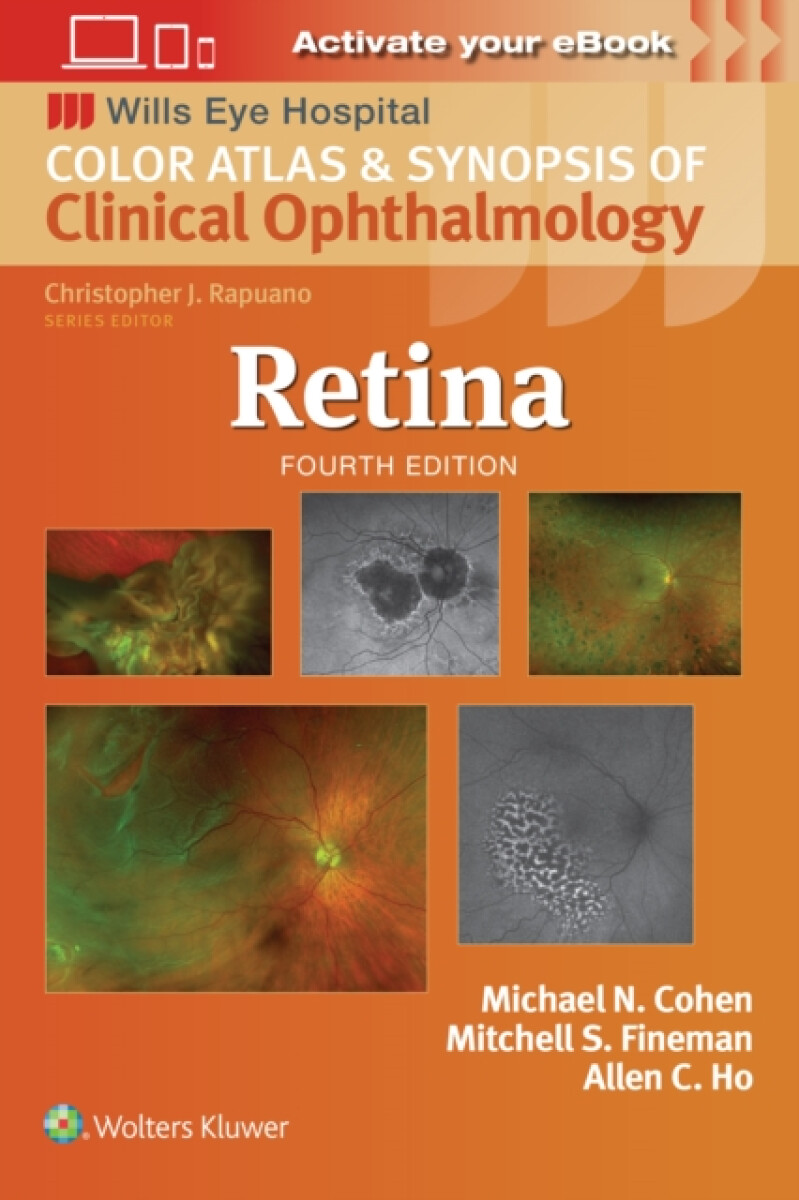 Kniha Retina