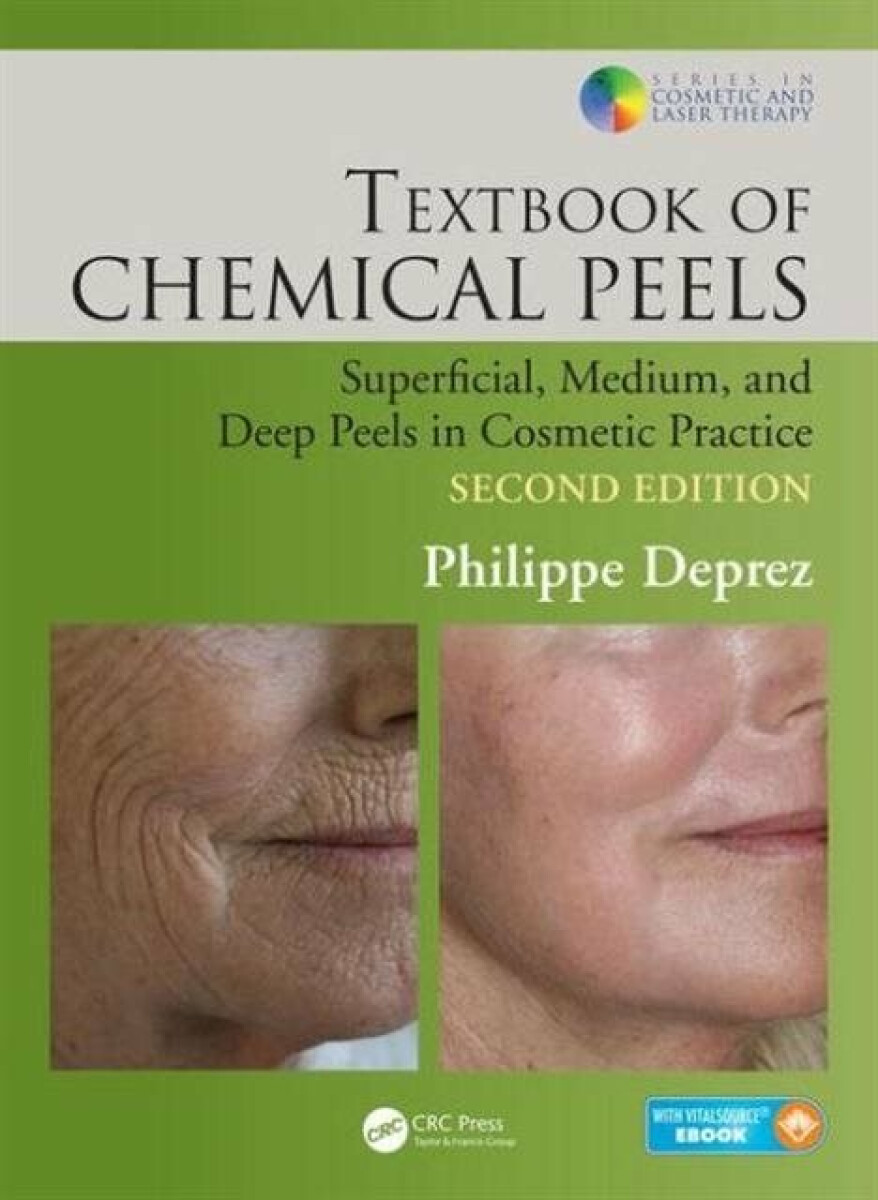 Kniha Textbook of Chemical Peels
