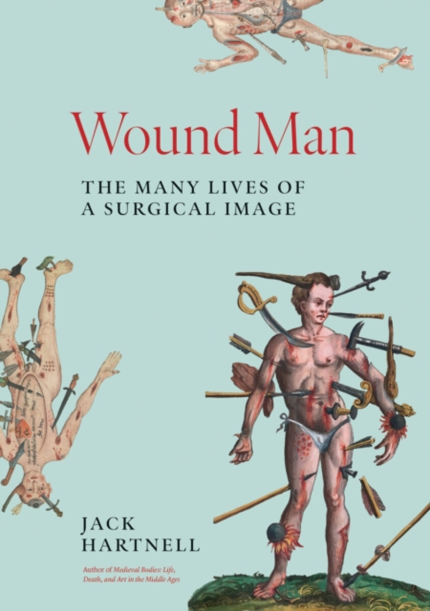 Kniha Wound Man