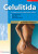 Celulitida 2. vyd. - Erika Hübelová,Alice Schmidtová