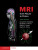 MRI from Picture to Proton - Donald W. McRobbie,Martin R. Prince,Martin J. Graves,Elizabeth A.  Moore