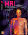 MRI in Practice - John Talbot,Catherine Westbrook