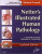 Netter's Illustrated Human Pathology Updated Edition - Gerhard R. F., MD, PhD  Krueger,L. Maximilian, M.D.  Buja