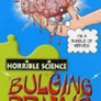 Bulging Brains