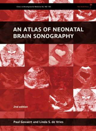 An Atlas of Neonatal Brain Sonography - Govaert Paul