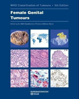 Female Genital Tumours: WHO Classification of Tumours (Medicine) 5th Edition - kolektiv autorů