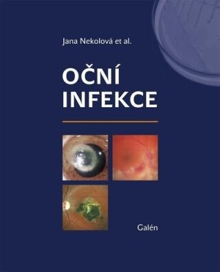Oční infekce - Nekolová Jana