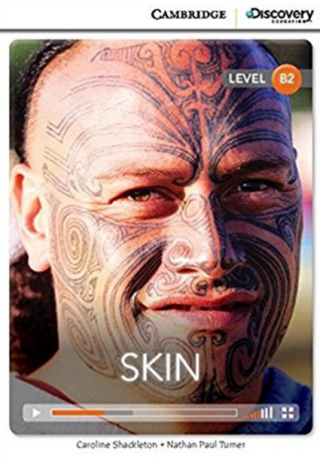 Skin Upper Intermediate Book with Online Access - Caroline Shackleton