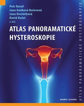 Atlas panoramatické hysteroskopie - Jana Dvořáčková,David Kužel,Petr Kovář,Daňková Kučerová Jana