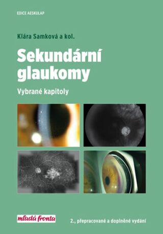 Sekundární glaukomy - Klára A. Samková